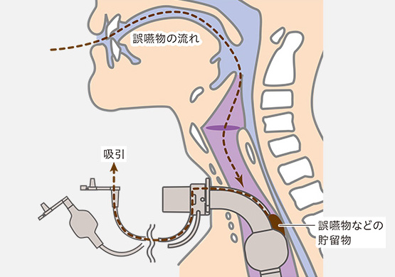 イメージ画像