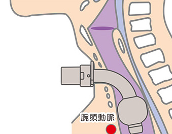 腕頭動脈の位置 ※成人イメージ