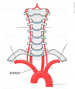 腕頭動脈（イメージ）
